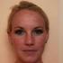 Уход за кожей после лазерной шлифовки лица: быстрое и эффективное восстановление